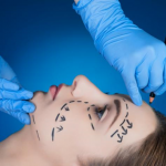 Things to Remember About Getting Facelifts in Winnipeg